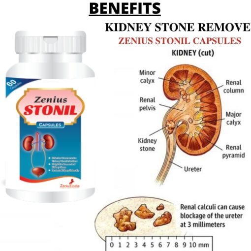 Zenius India Zenius Stonil Capsule For Kidney Stone Removal Treatment - 60 Capsules