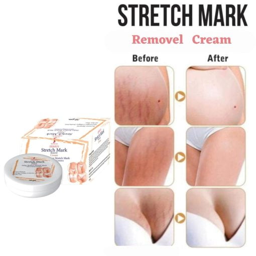 Zenius India Zenius Stretch Mark Cream For Body Stretch Marks Removal Medicine | Stretch Marks Removal Cream | Stretch Marks Cream